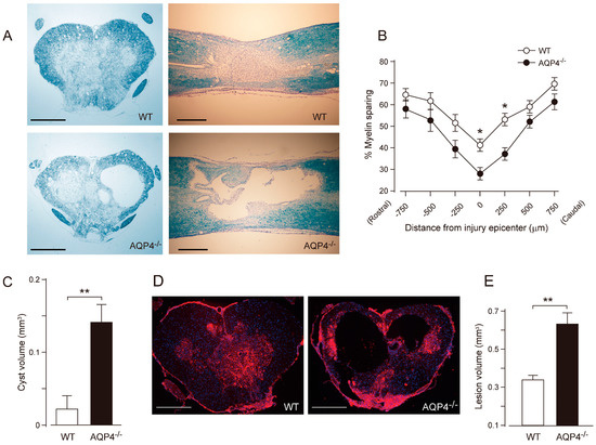The Role of Aquaporins in Spinal Cord Injury