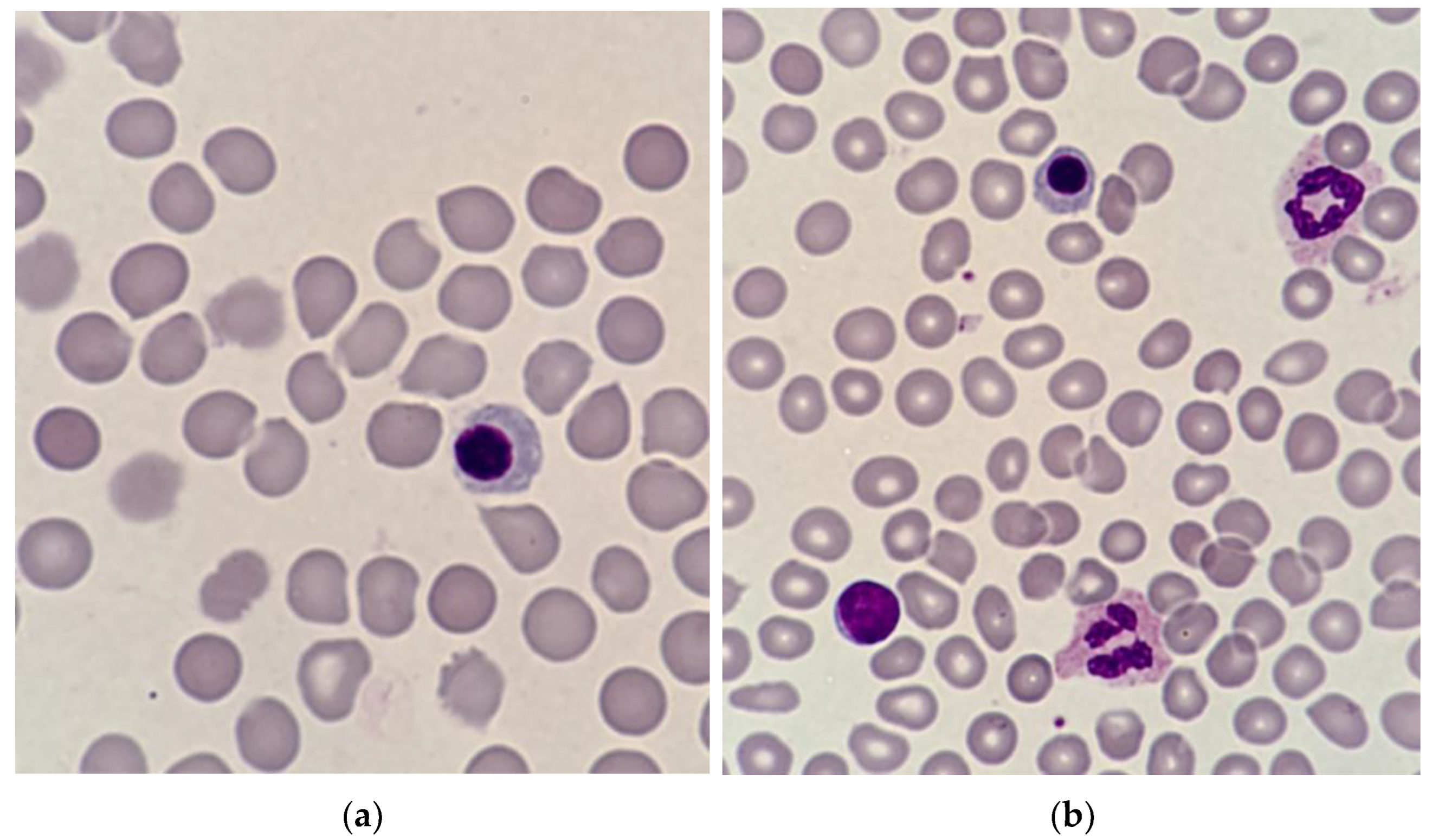 RBC Blood Test: Normal Ranges and Diagnostic Uses