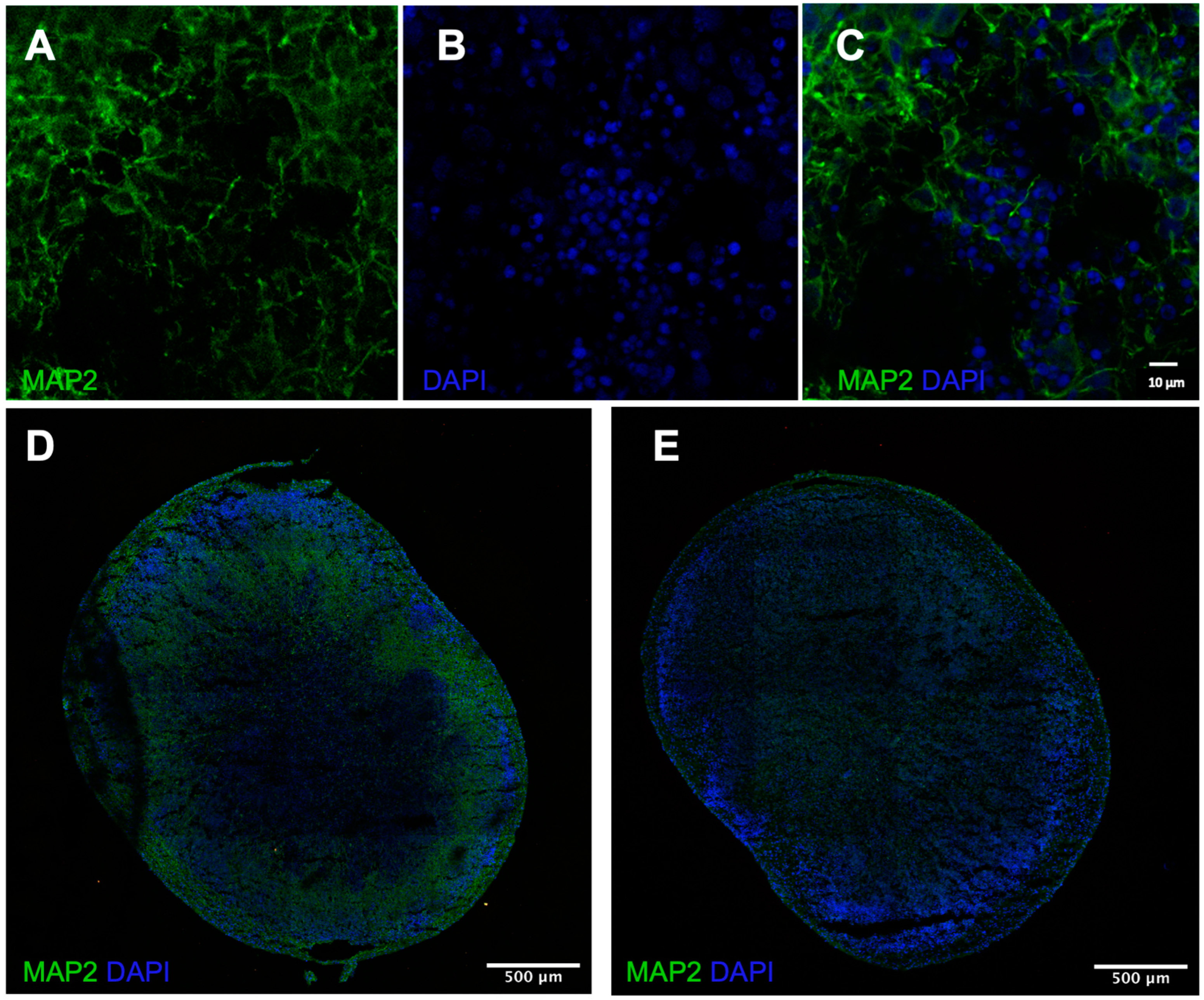 Treating Hyperexcitability in Human Cerebral Organoids