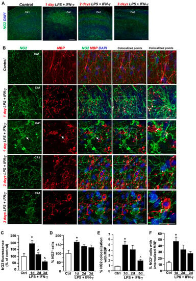 Cells | Free Full-Text | Contribution of Oligodendrocytes, Microglia ...