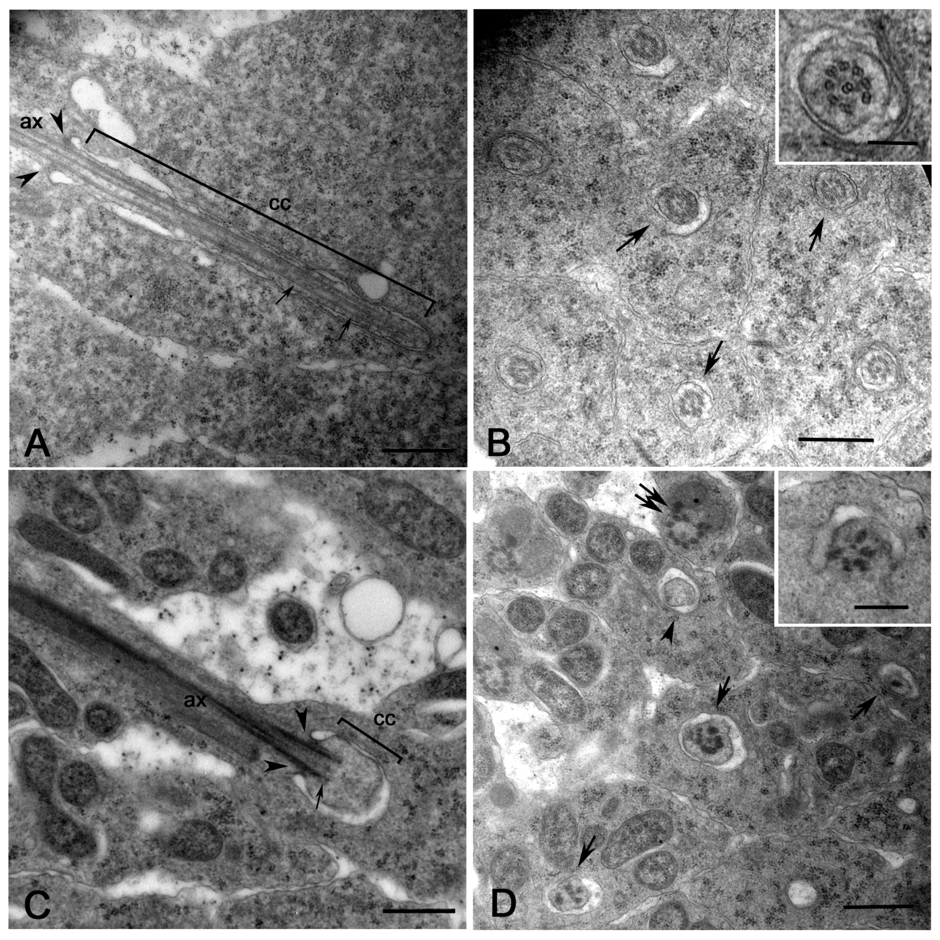 Cells 12 02337 g006 Cells 12 02337 g006
