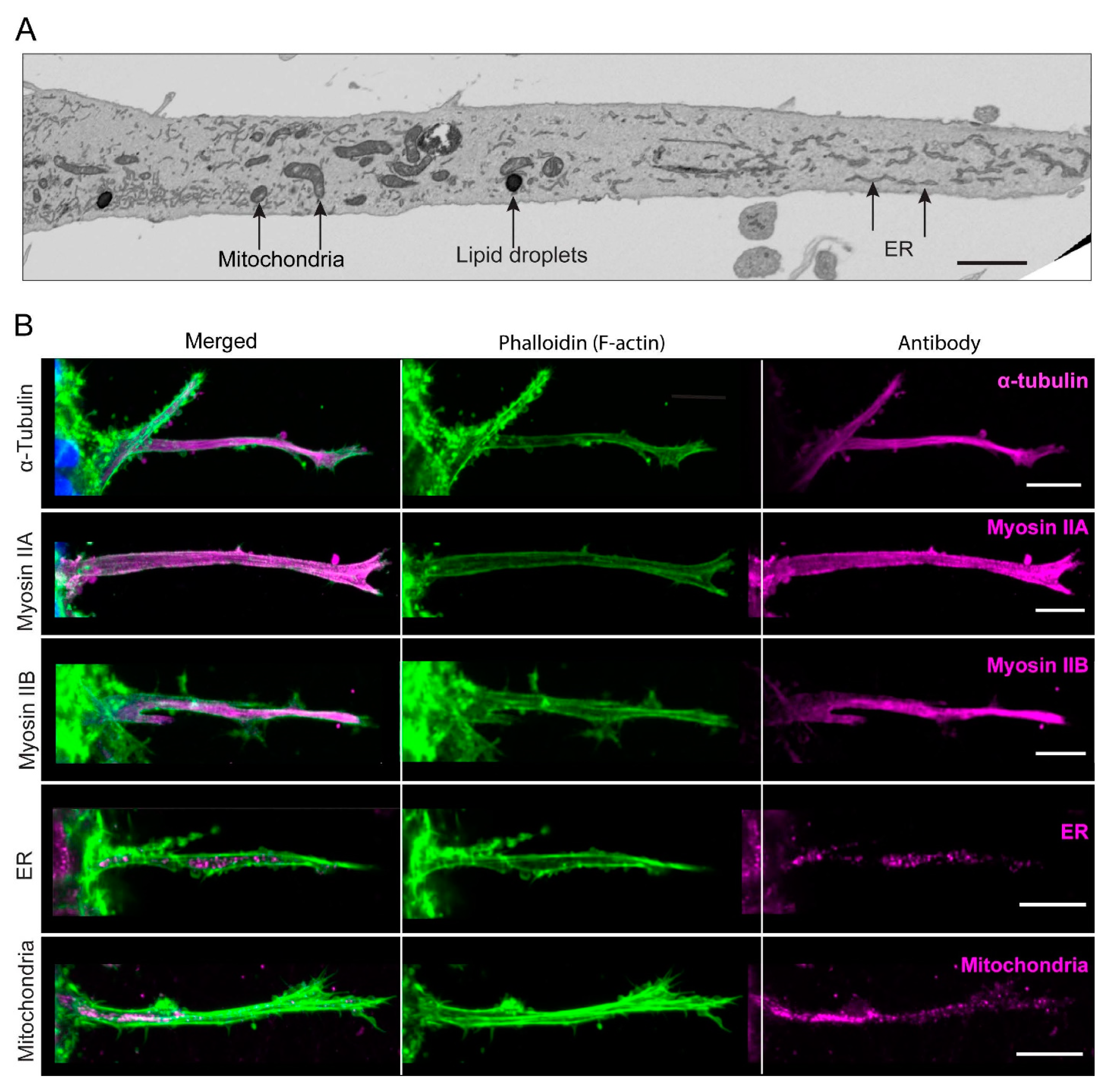 Cells 12 02474 g006 Cells 12 02474 g006