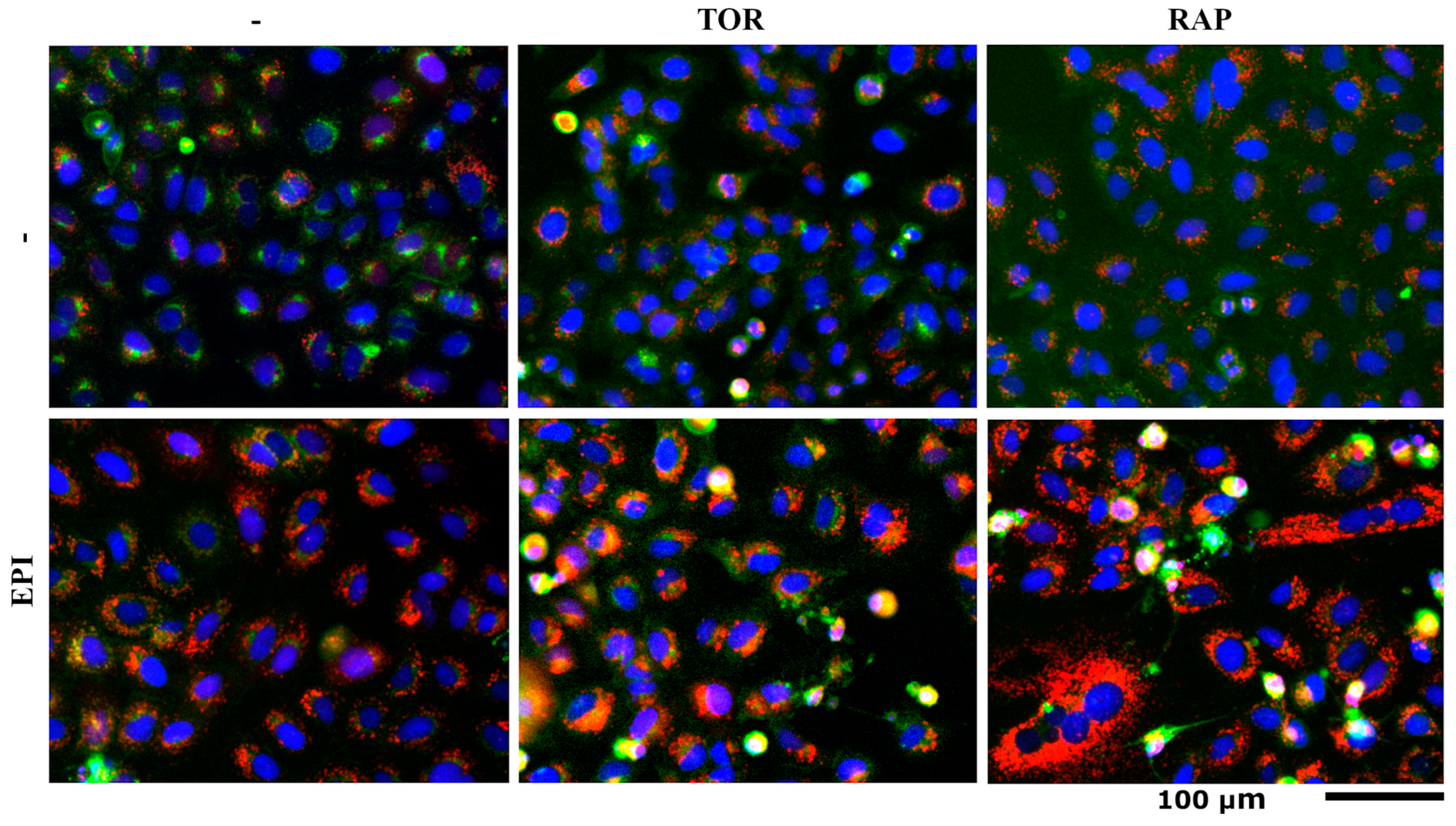 Cells 12 02588 g005 Cells 12 02588 g005