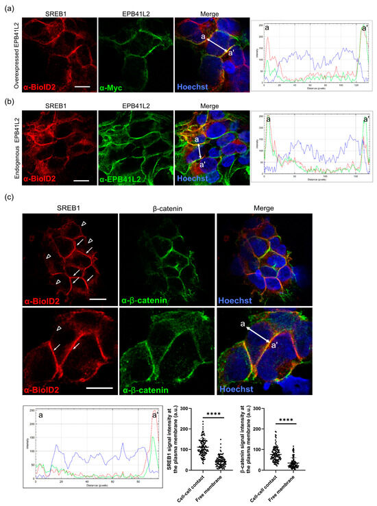 Siwakorn ページ Prostaglandin E2-EP2/EP4 signaling induces immunosuppression