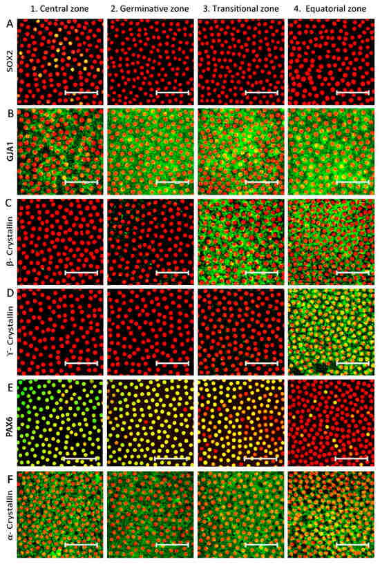 Cells | Free Full-Text | Towards the Identification and ...