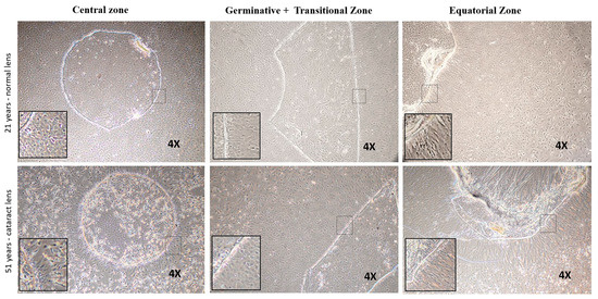 Cells | Free Full-Text | Towards the Identification and ...