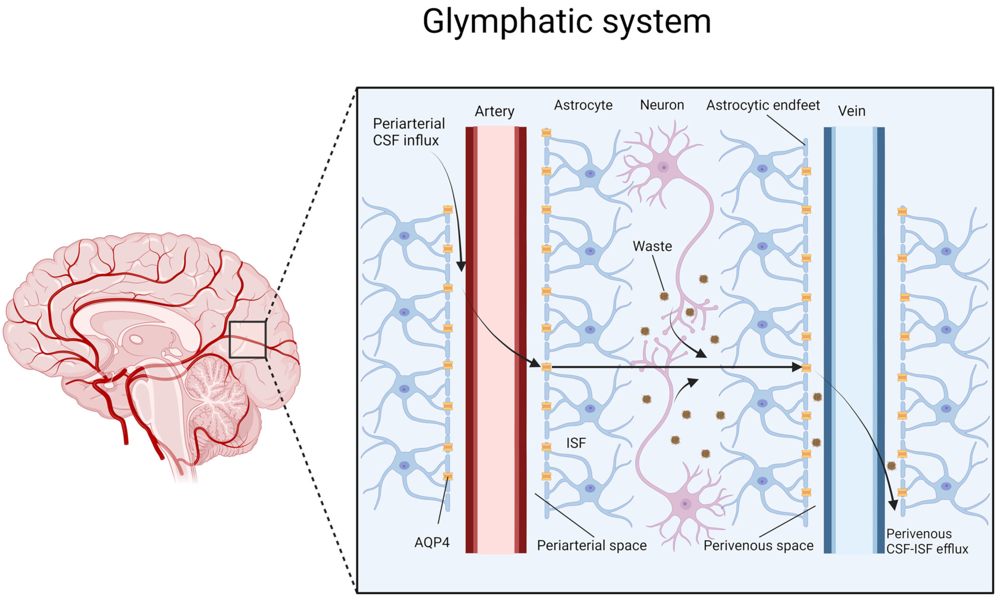 Glymphatic System Pathology and Neuroinflammation as Two Risk Factors of  Neurodegeneration