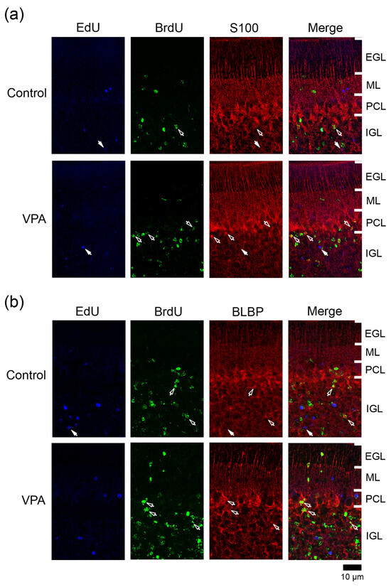 Tracking of Internal Granular Progenitors Responding to Valproic