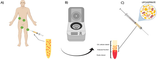 Hepatotoxicity of Small Molecule Protein Kinase Inhibitors