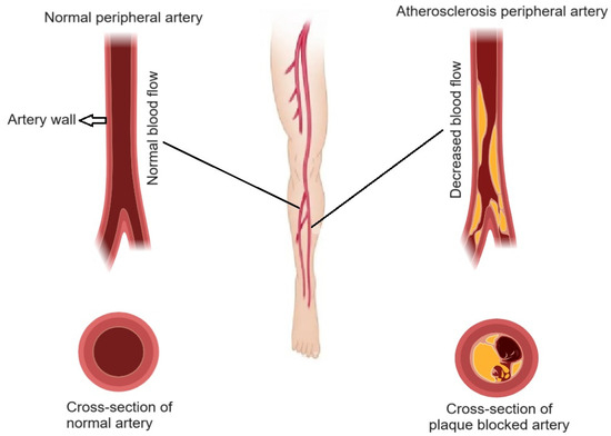 zzz A Comprehensive Review of Cardiovascular Disease Management