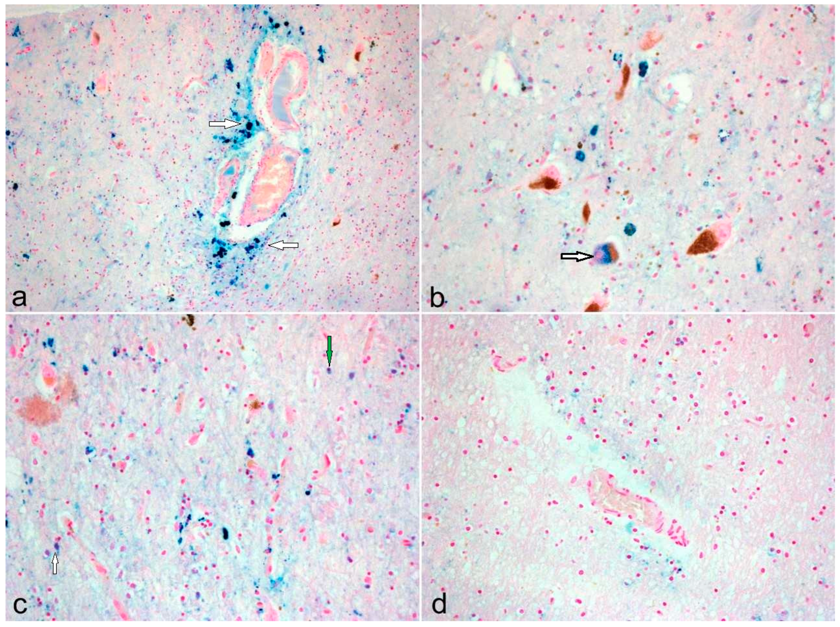 Cells 13 01511 g001 Cells 13 01511 g001