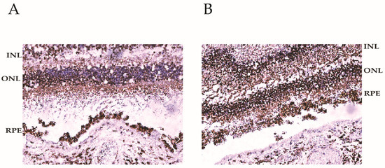The Endogenous Expression of BMI1 in Adult Human Eyes