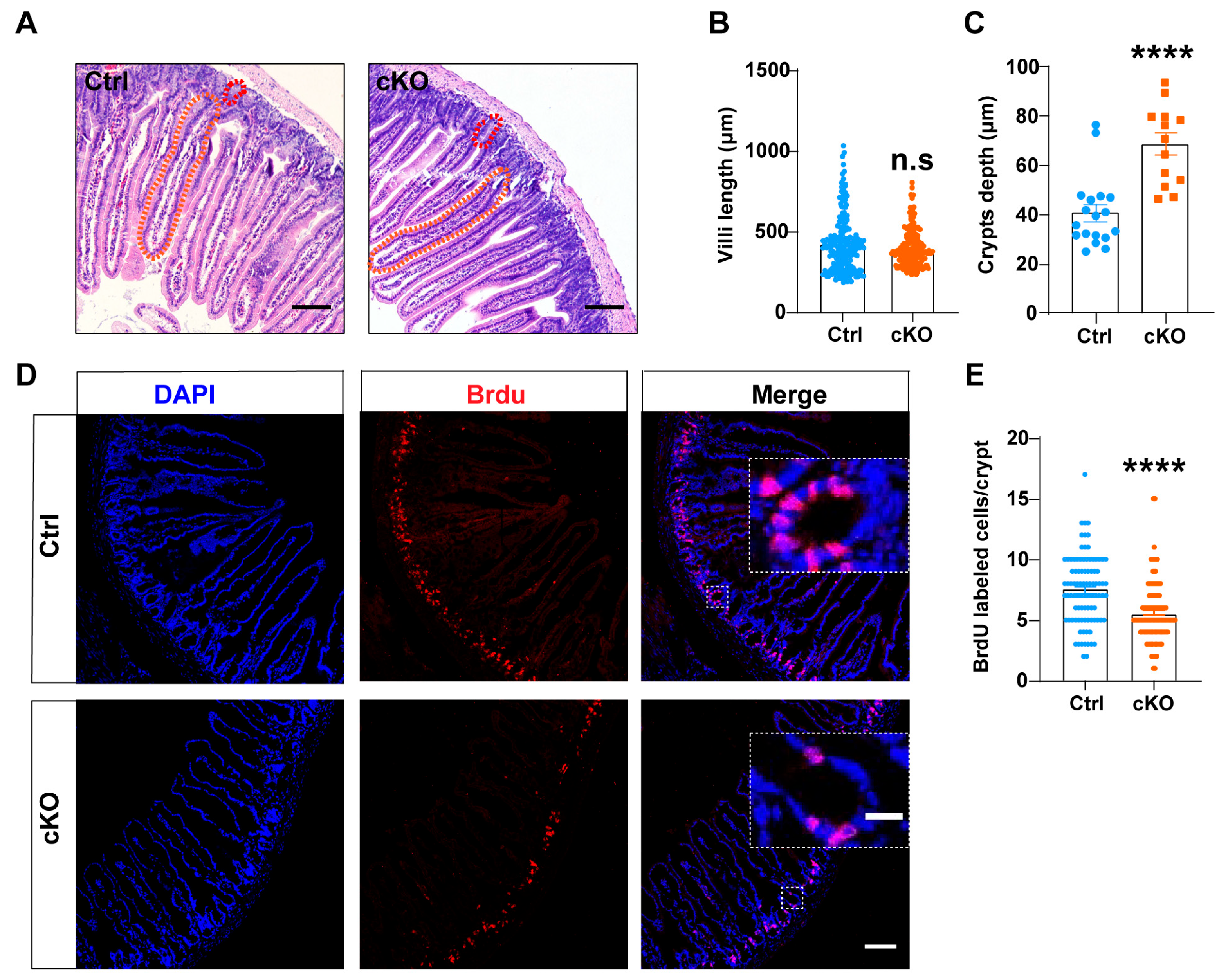 The TMEM63B Channel Facilitates Intestinal Motility and The TMEM63B Channel Facilitates Intestinal Motility and