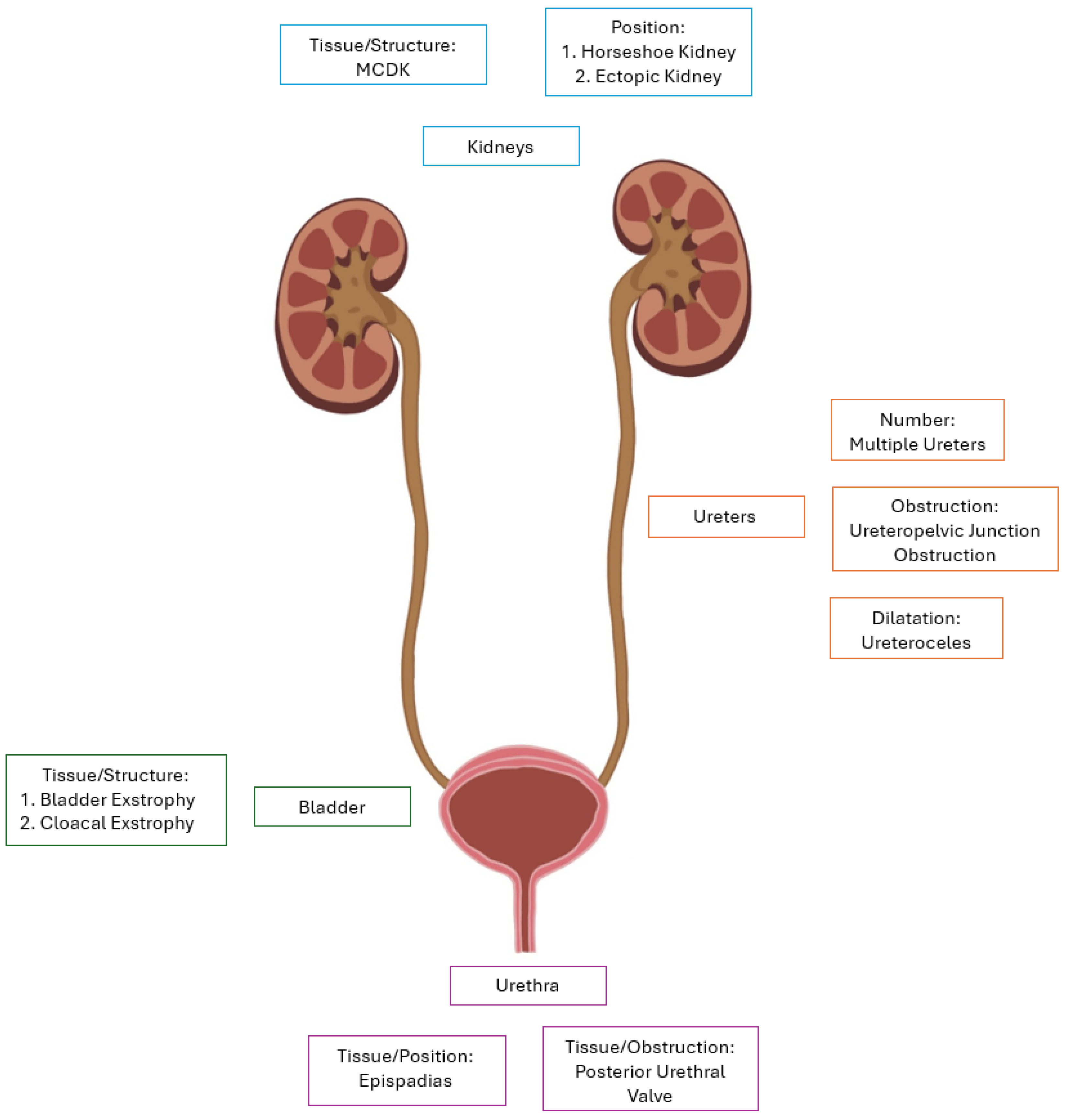Pathophysiology of Congenital Anomalies of the Kidney and Urinary 