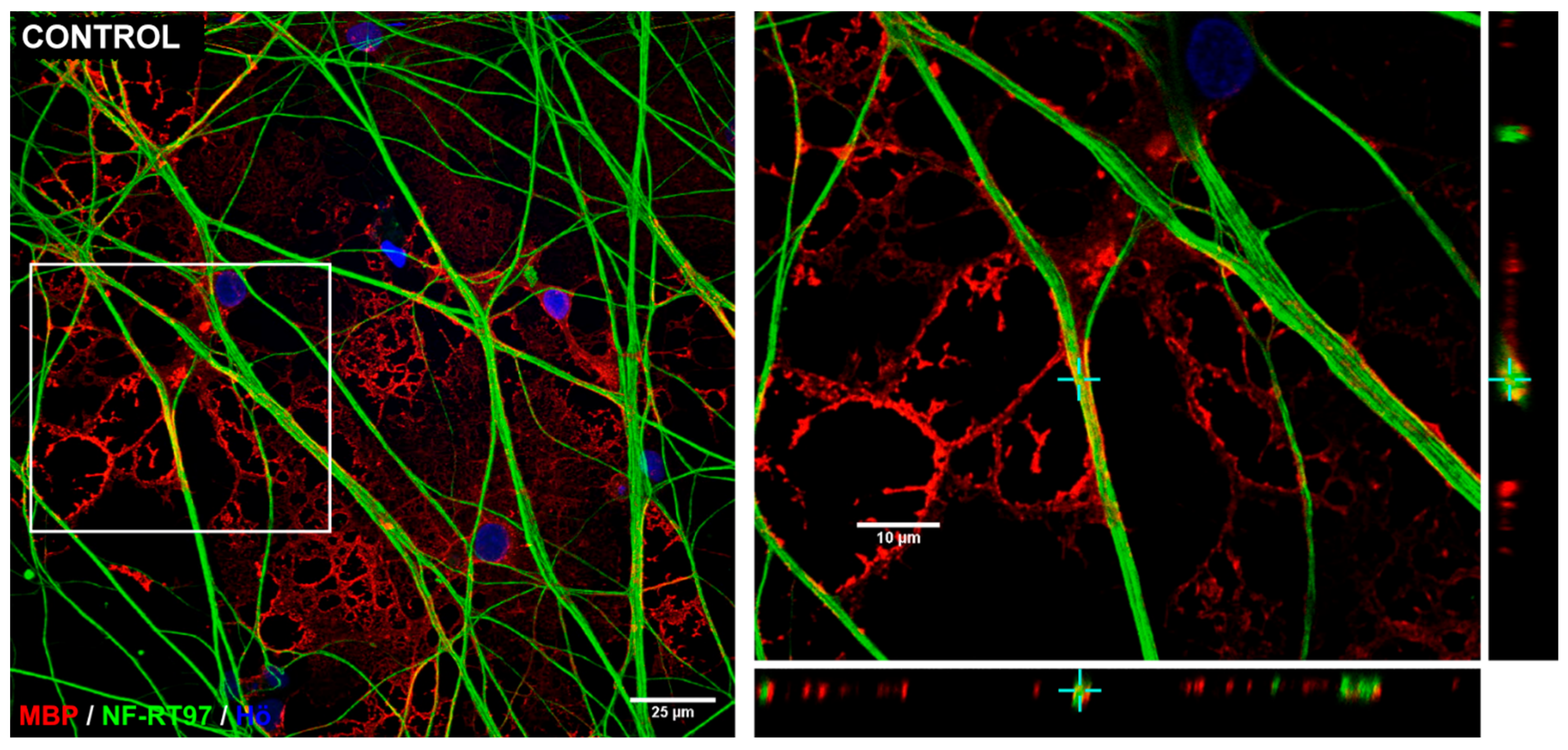 Cells 14 00533 g011a