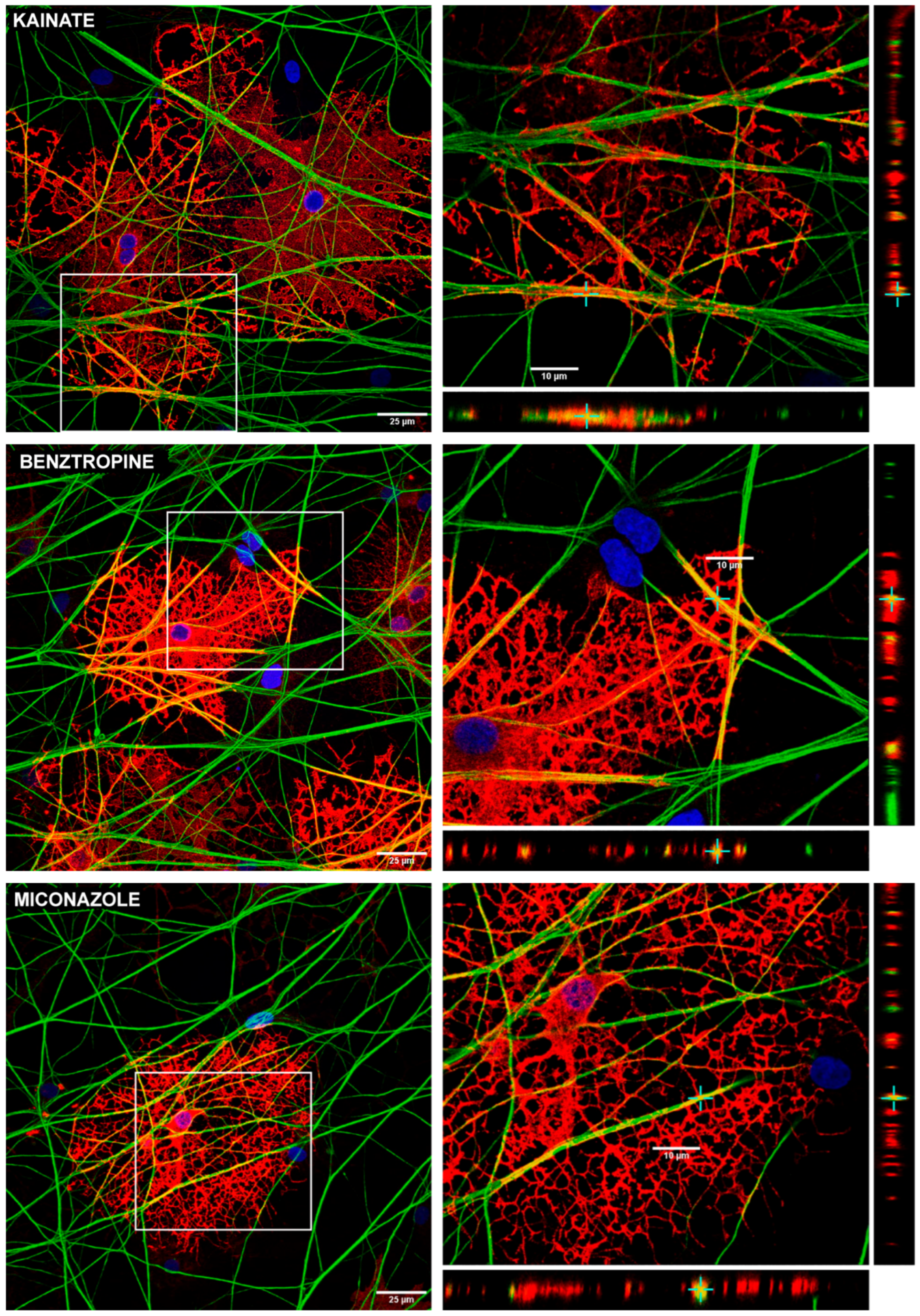 Cells 14 00533 g011b