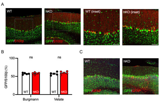 The Competitive Loss of Cerebellar Granule and Purkinje Cells