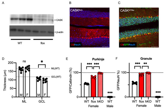 The Competitive Loss of Cerebellar Granule and Purkinje Cells