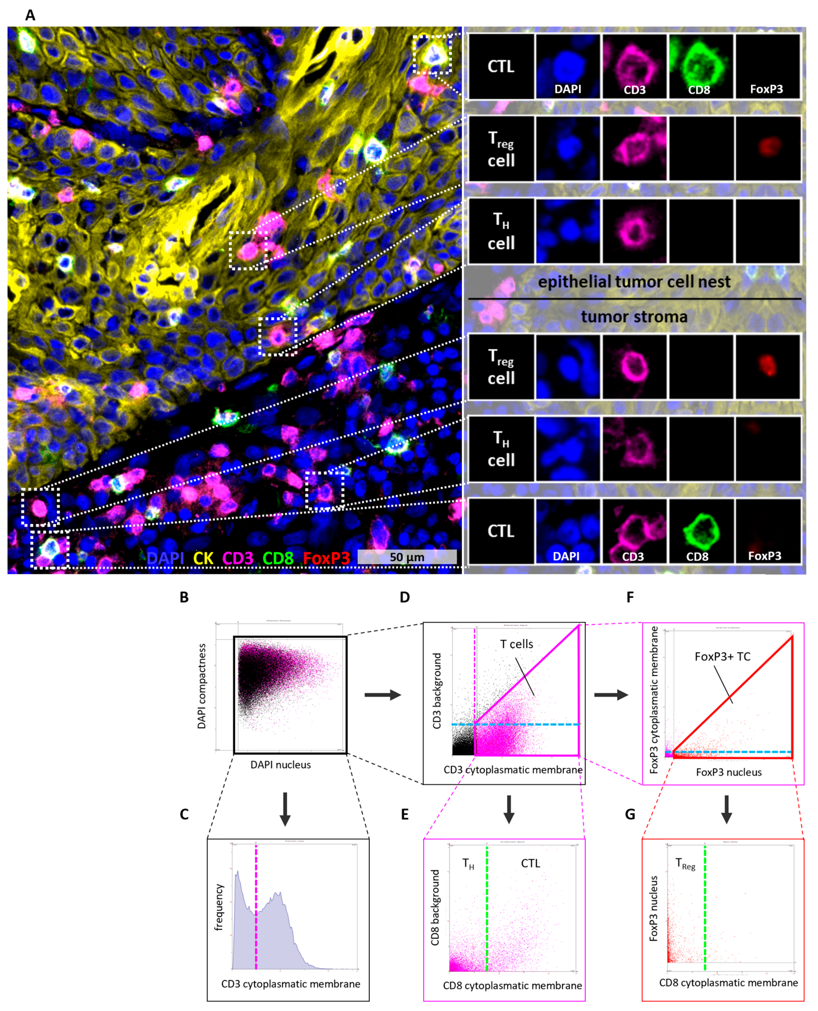 健康・医学 The CELL Spatial Distribution and Prognostic Value of T Cell Subtypes