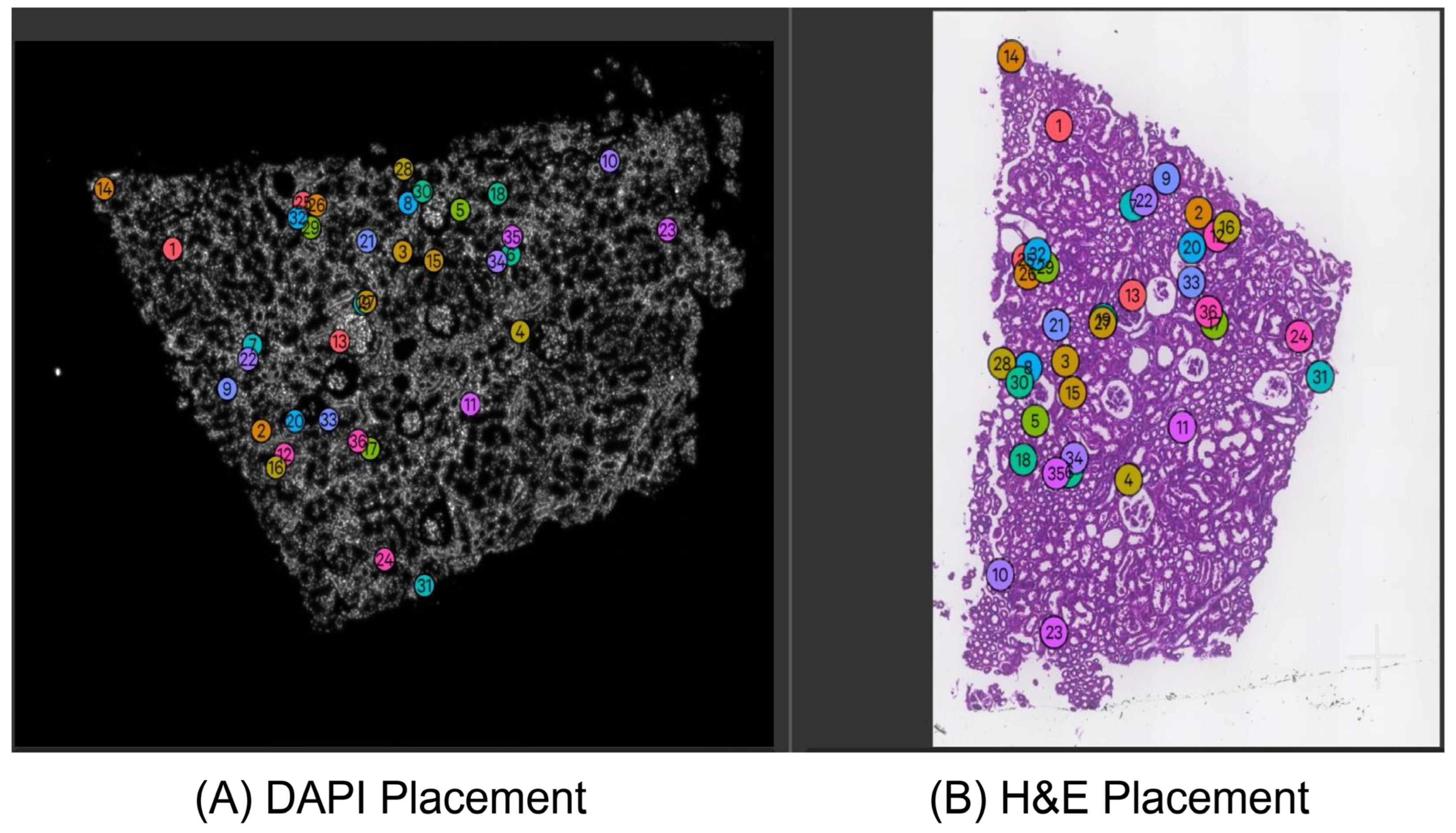 AYANAページ Defining Keypoints to Align H&E Images and Xenium DAPI