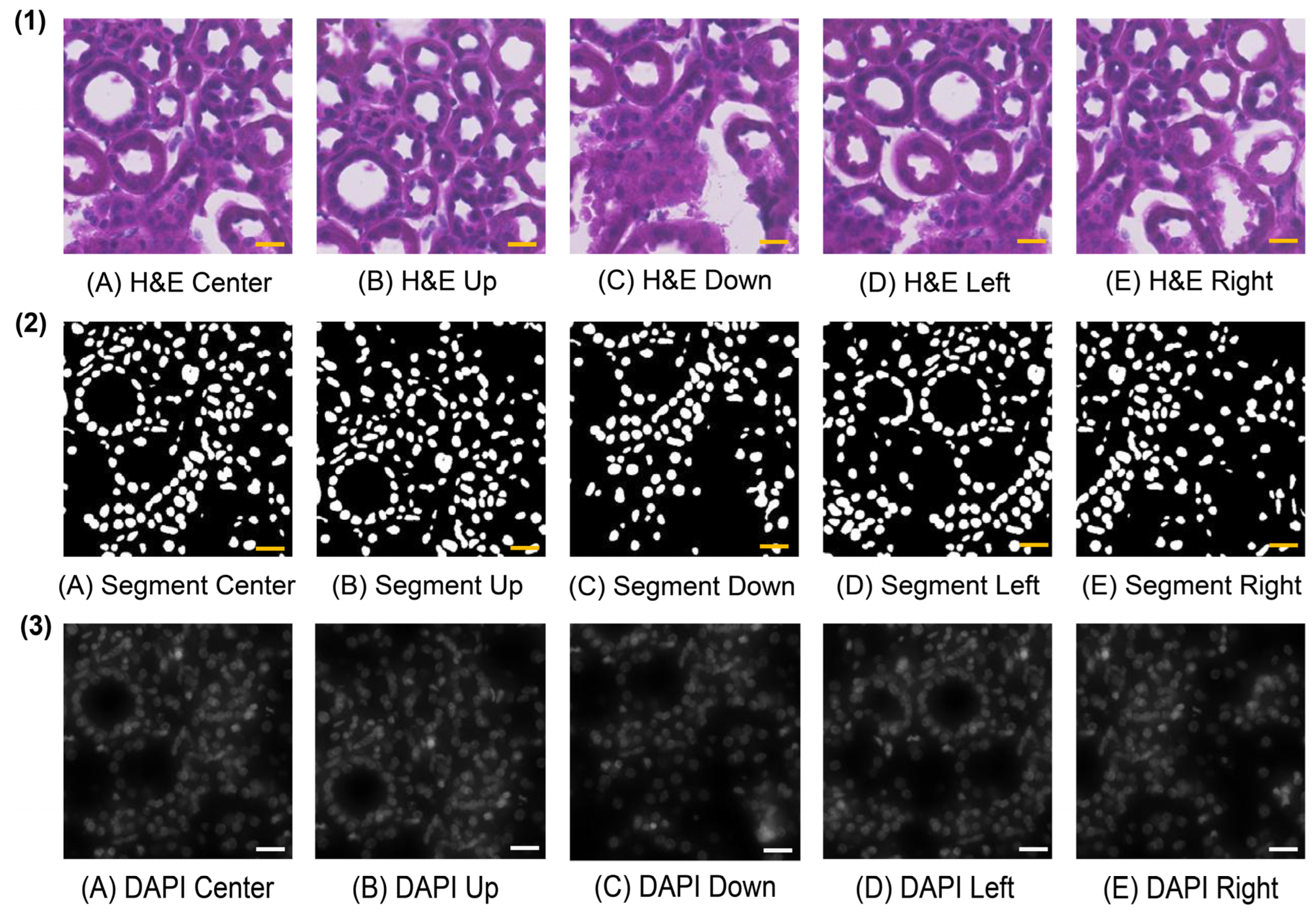 Defining Keypoints to Align H&E Images and Xenium DAPI