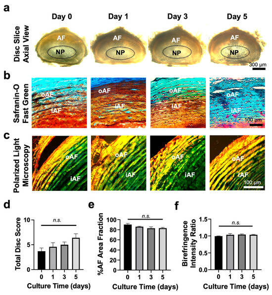 An Ex Vivo Intervertebral Disc Slice Culture Model for