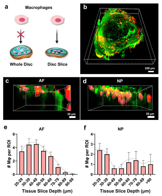 An Ex Vivo Intervertebral Disc Slice Culture Model for