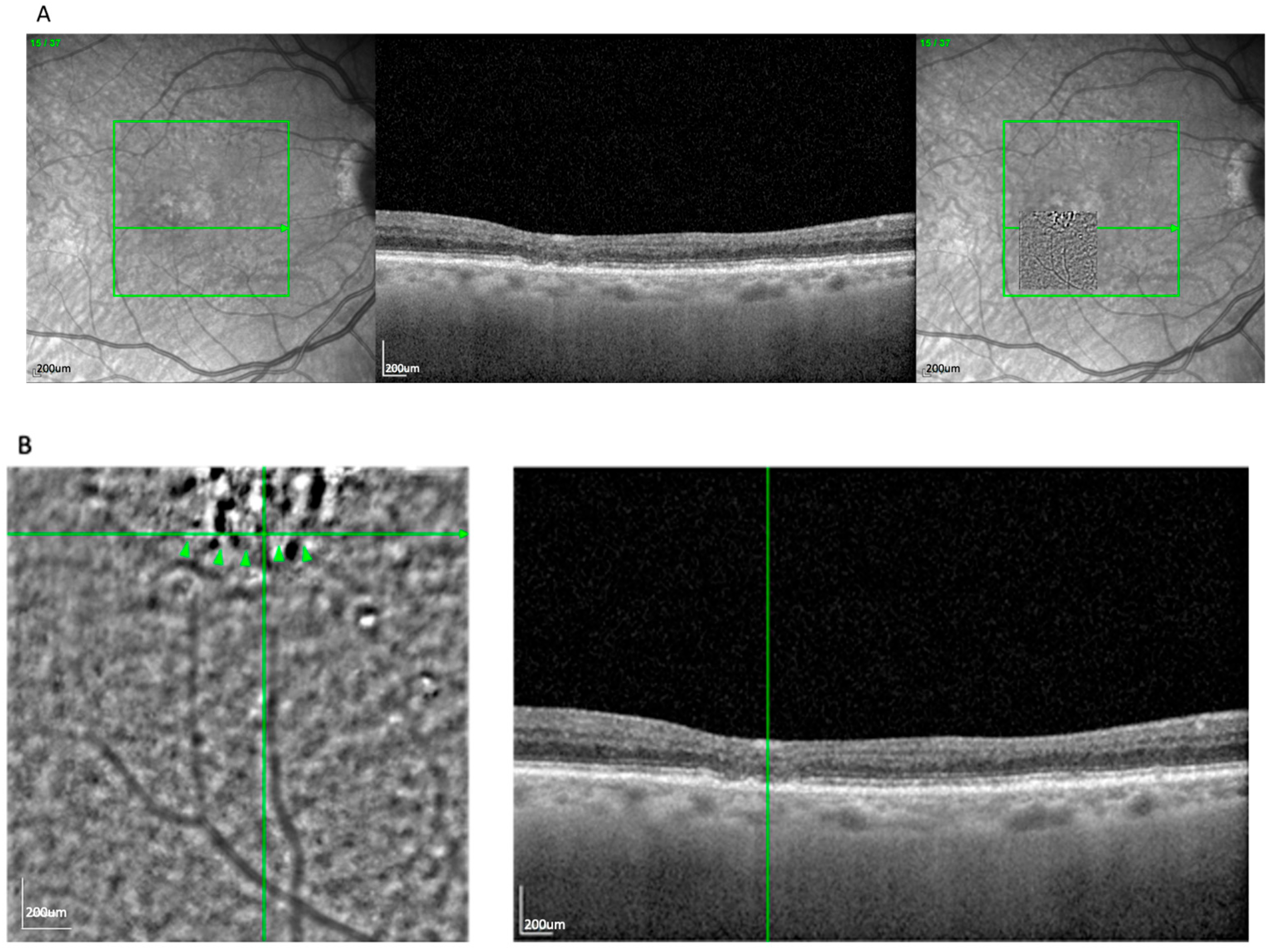Cells 14 01308 g001a