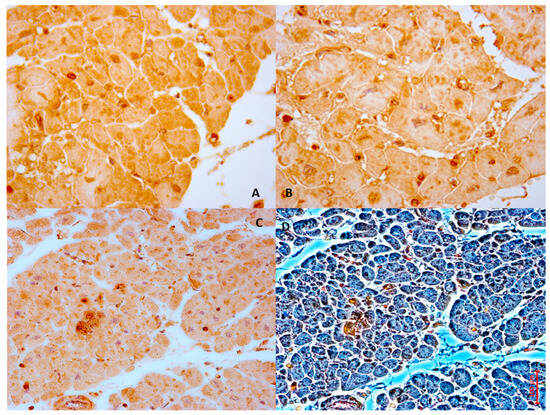 Myocardial Ischemia/Reperfusion Injury: Molecular Insights