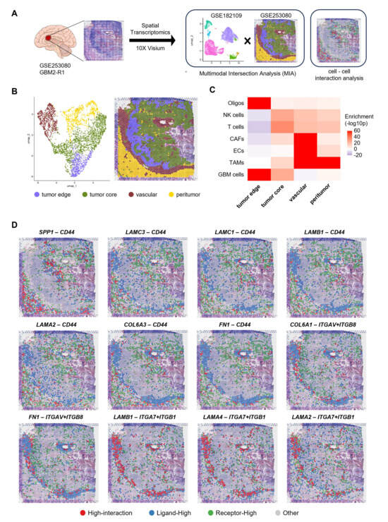 Integrated Spatial and Single-Cell Transcriptomics Reveals Poor ...
