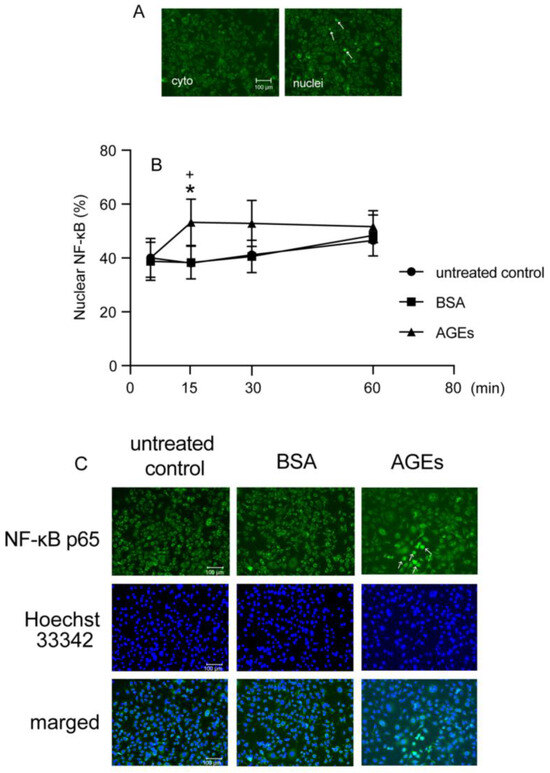 Advanced Glycation End Products Promote PGE2 Production in Ca9-22