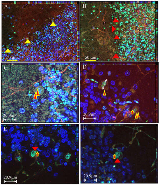 Dual Characteristics of Apoptosis and Survival in Cerebellar Purkinje ...