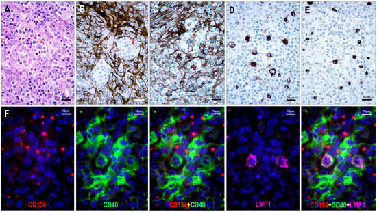 Immunomorphological Analysis of the CD40–CD154 Interaction in T