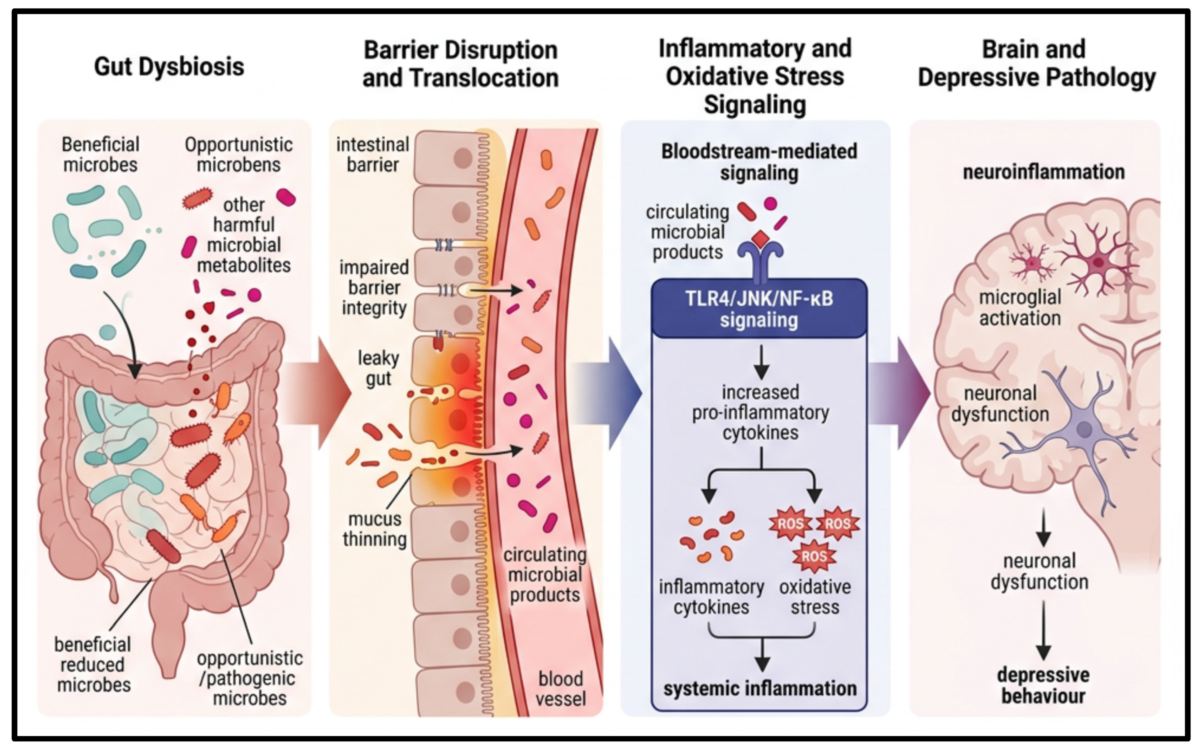 その他 DAI Gut Dysbiosis-Mediated Major Depressive Disorder: A Review of
