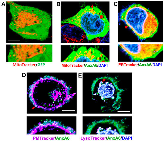 Annexin A6 Modulates the Secretion of Pro-Inflammatory Cytokines