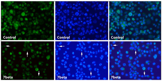 Reduced Membrane CD163 Expression in 7-Oxysterol-Induced Apoptosis