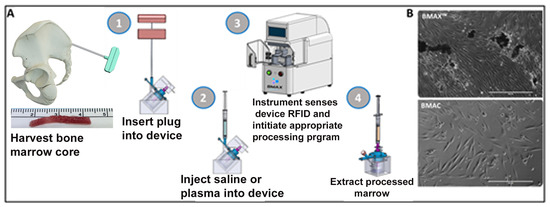 Preclinical Evaluation of Human Donor-Derived Micronized Bone