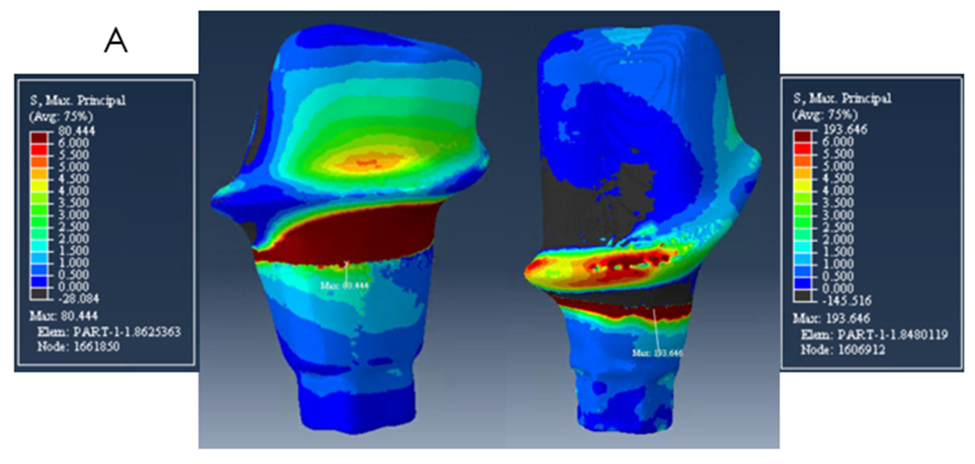 Ceramics 05 00004 g004 Ceramics 05 00004 g004