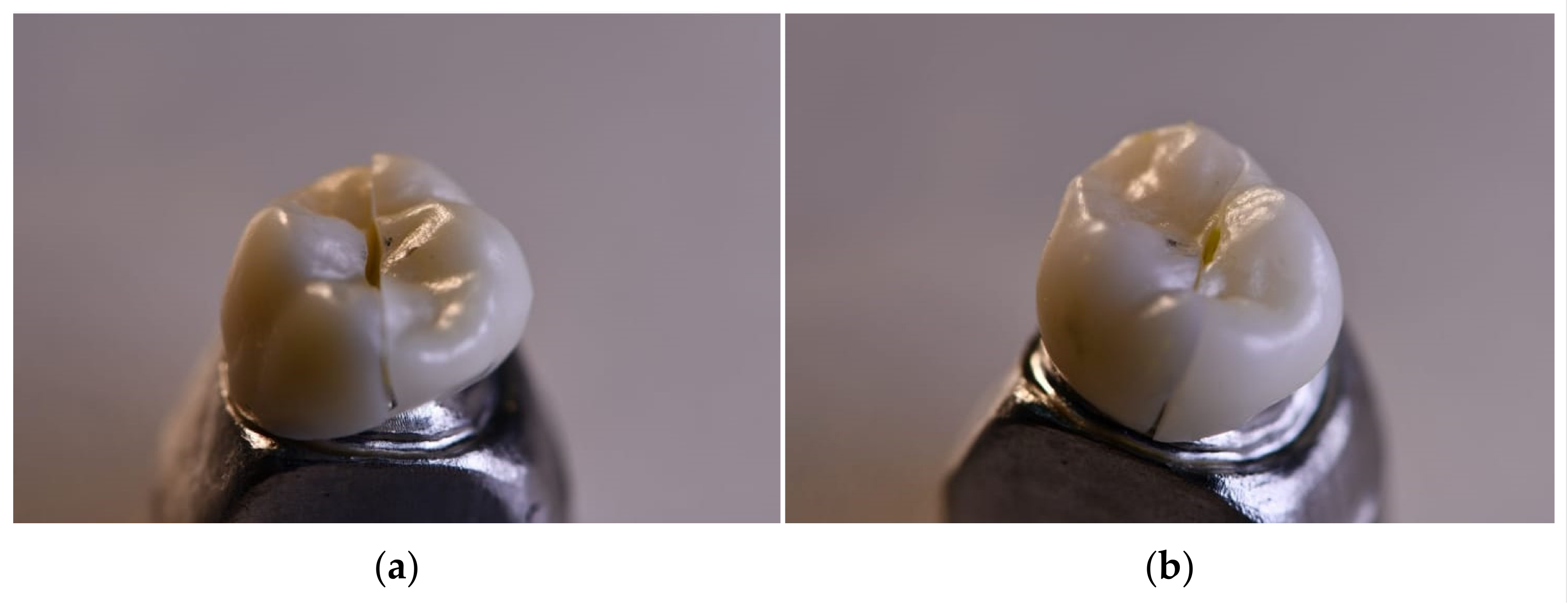 Ceramics 06 00071 g006 Ceramics 06 00071 g006