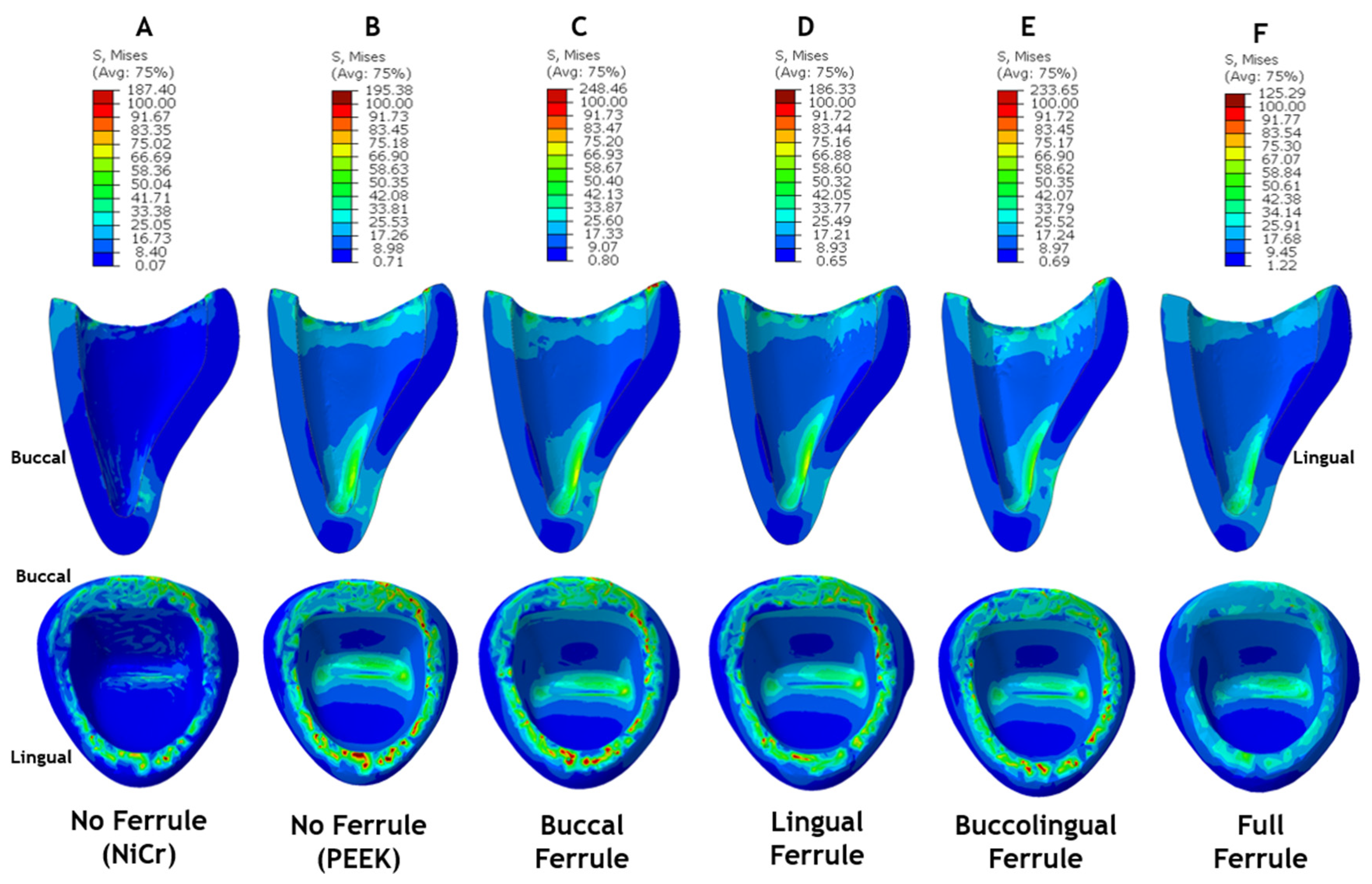 Ceramics 06 00137 g007