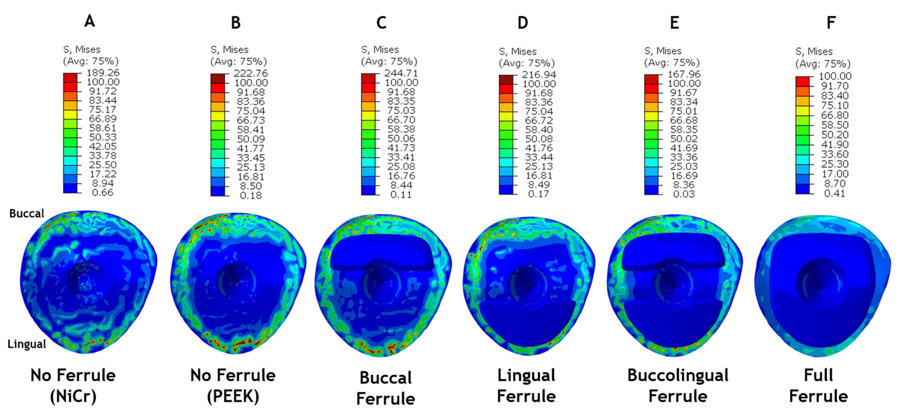 Ceramics 06 00137 g008