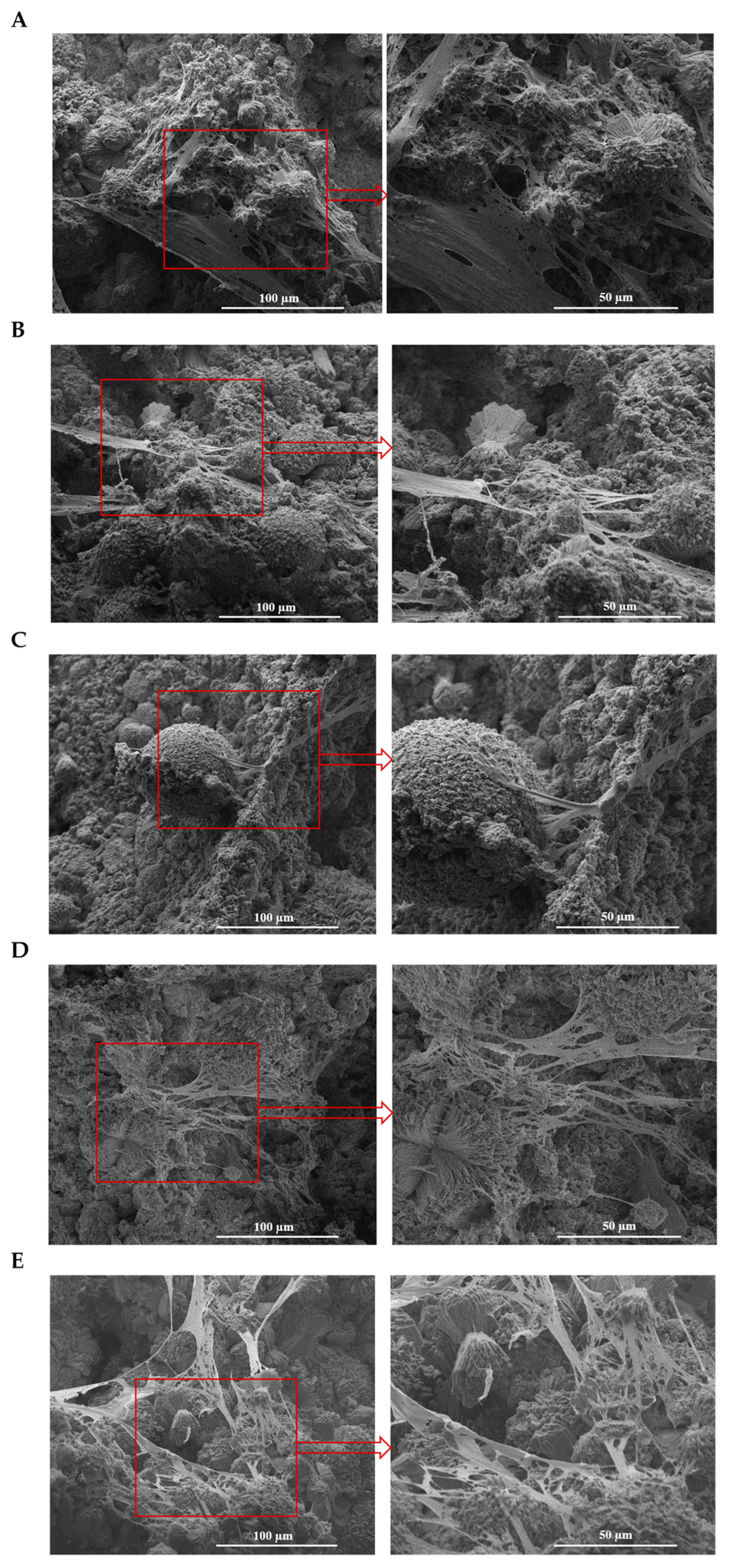 Ceramics 06 00143 g008