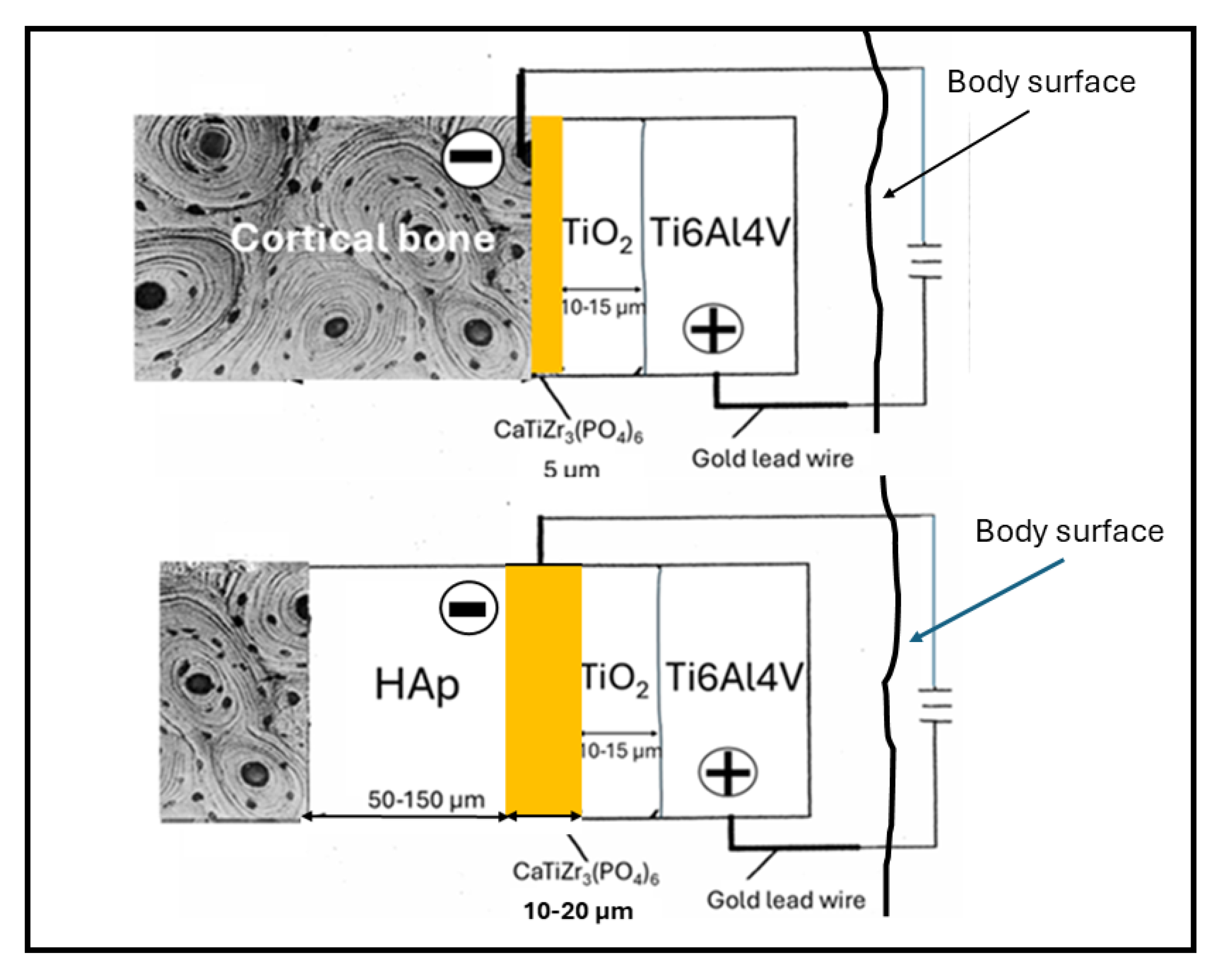 Osseoconductive CaTi4-zZrz(PO4)6 Ceramics: Solutions Towards
