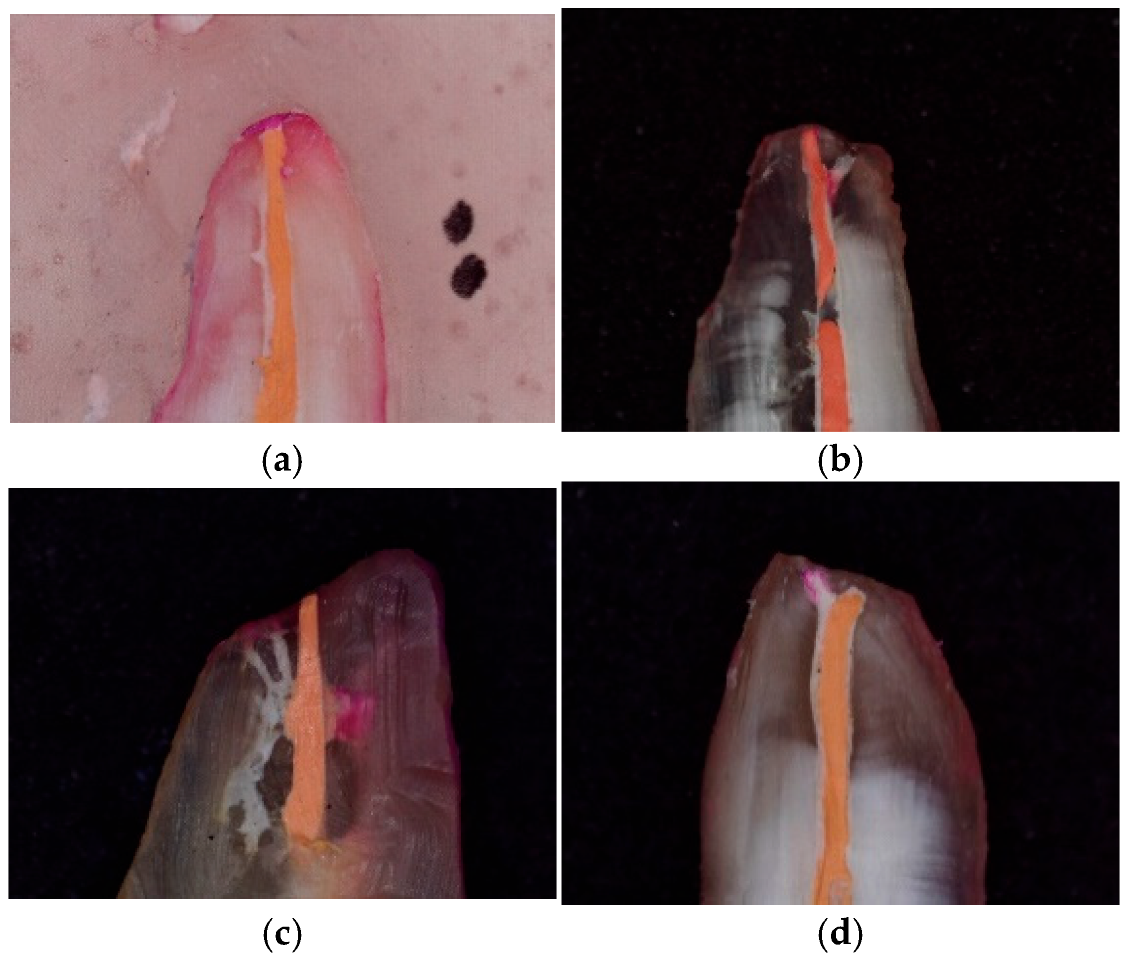Ceramics 08 00065 g004