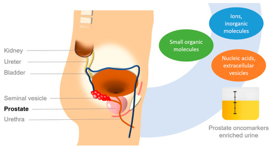 prostate mri pi rads 3 a prostatitis férfiak által leesett