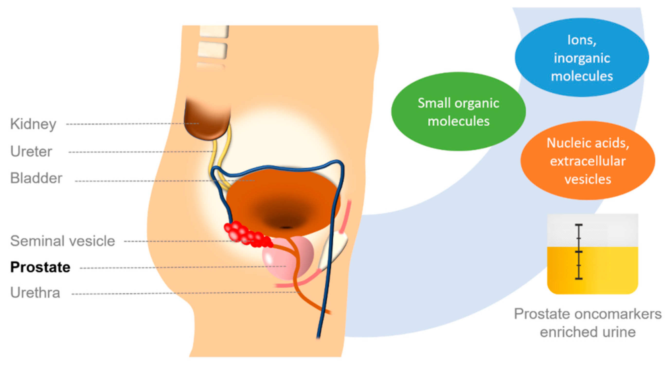 prostatitis epidemiológia)