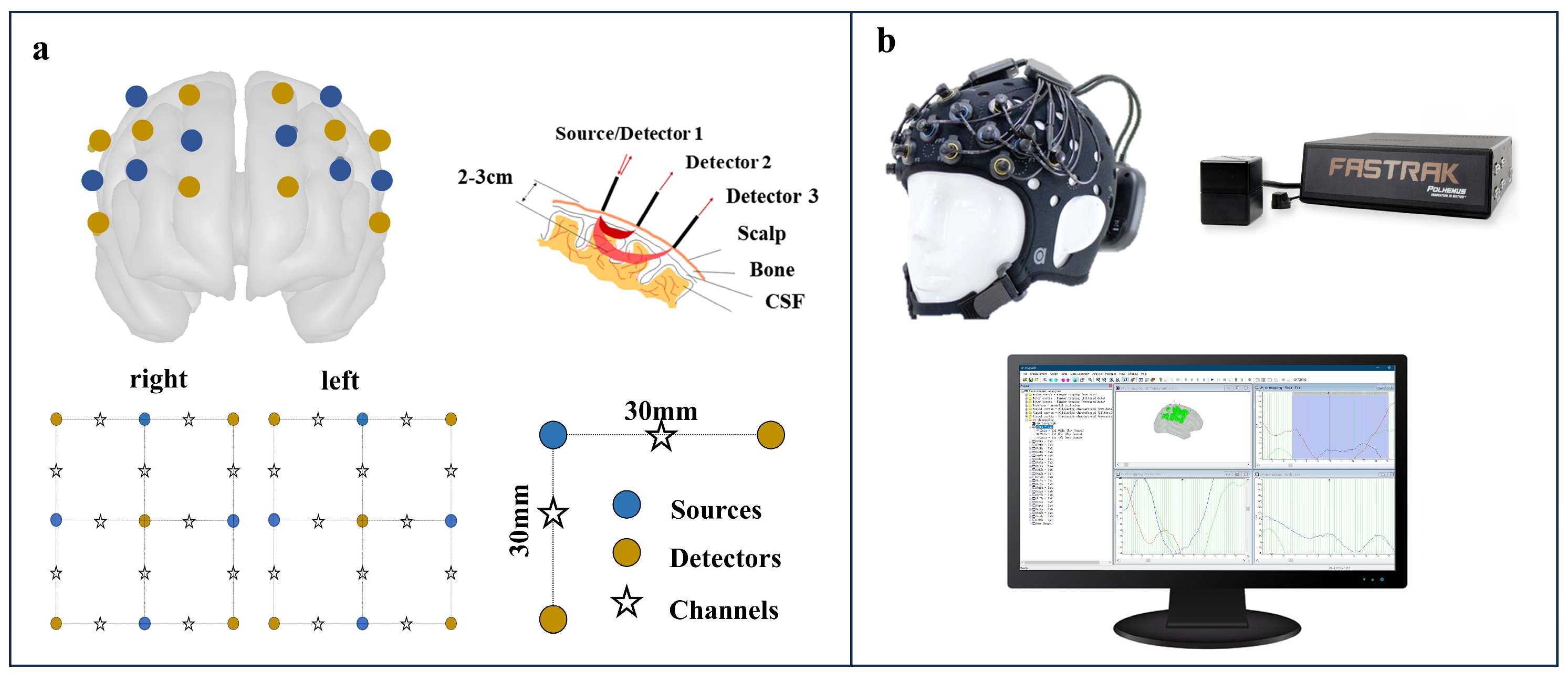 Chemosensors 13 00036 g001