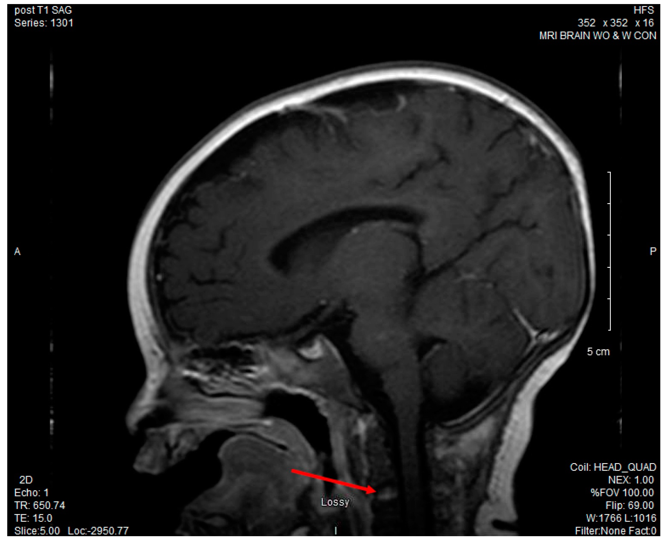 Children 04 00087 g001 550