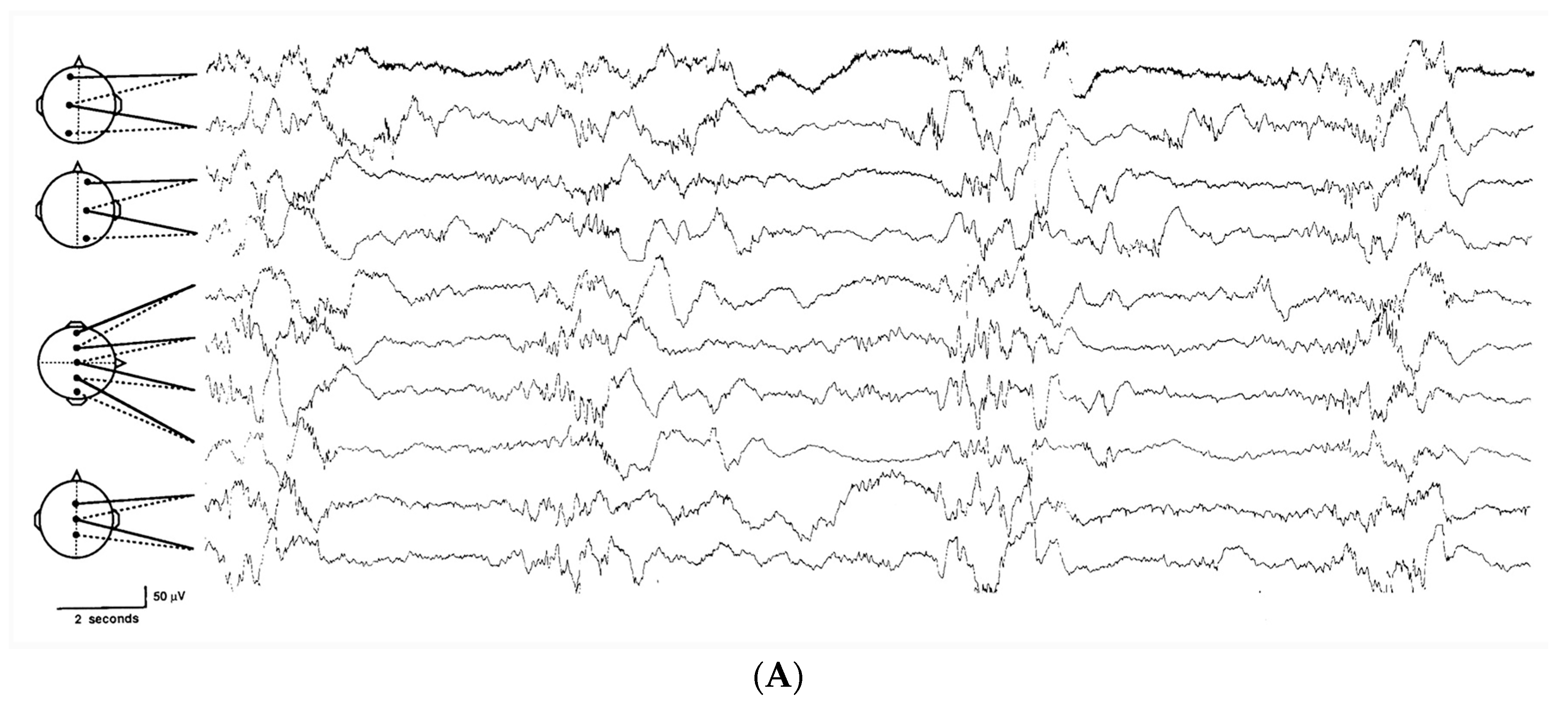 Children 04 00090 g002a