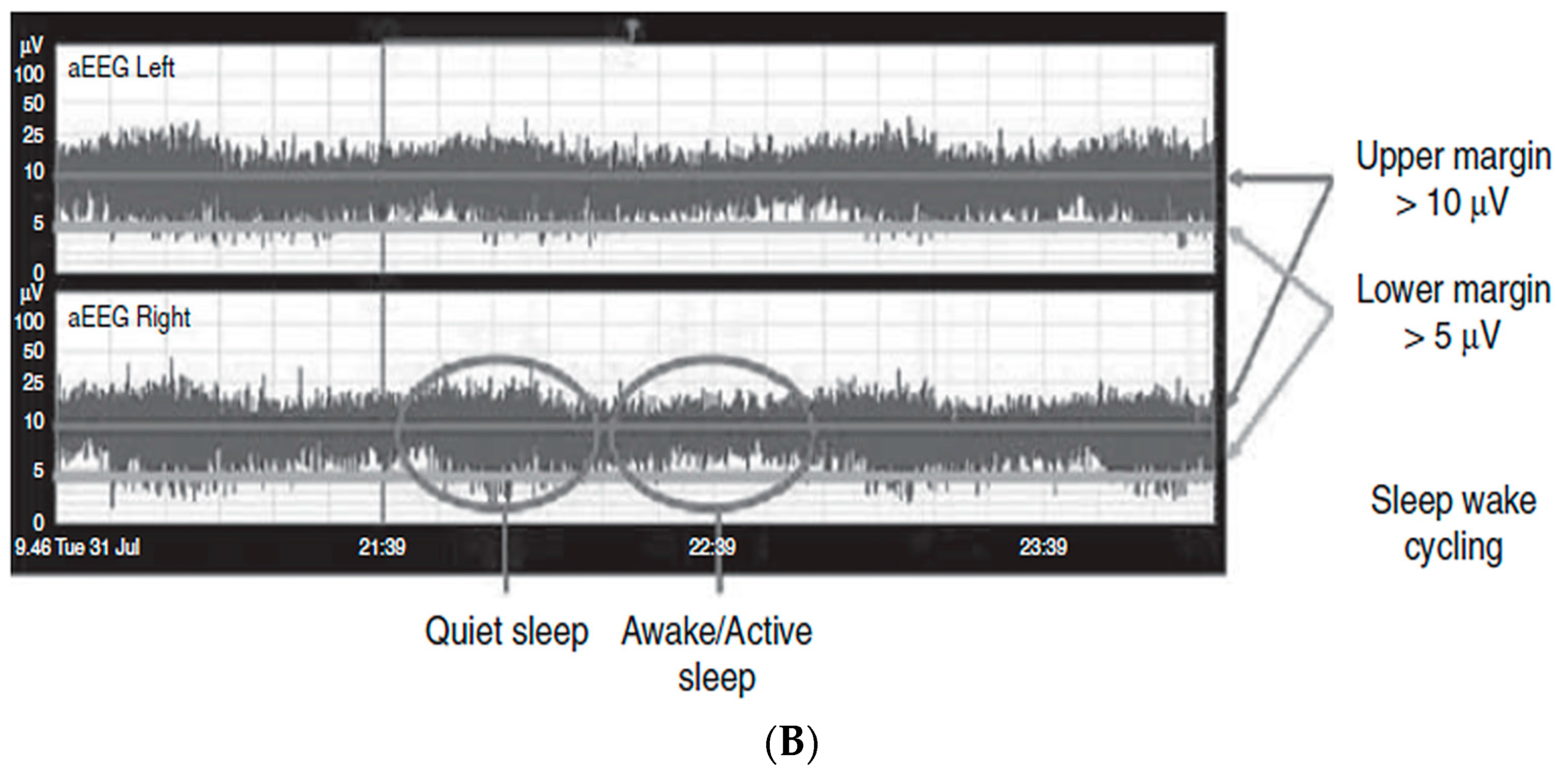 Children 04 00090 g002b